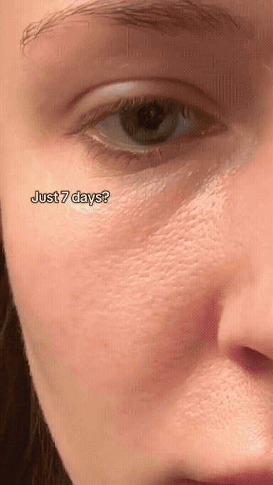 SEOUL 1988 Korean Cream  : Retinal Liposome 4% + Fermented Bean. Removes pigmentation