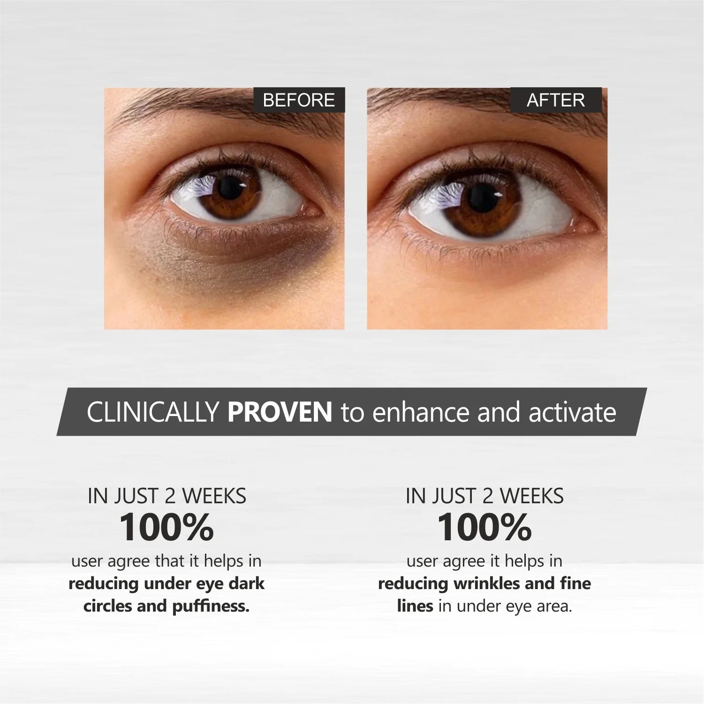 SEOUL 1988 Korean Cream  : Retinal Liposome 4% + Fermented Bean. Removes pigmentation